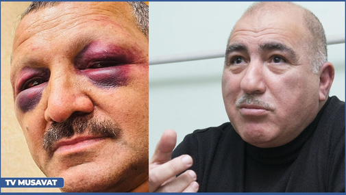 Tofiq Yaqublunun döyülməsi və şəhidlər dəfn olunan gün o aksiyaya kimlərə lazım idi?