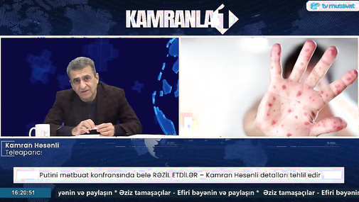 Qazı Dünyaya verən də biz, qazı vətəndaşımıza limitlə verən də biz... - Kamran Həsənlidən ETİRAZ